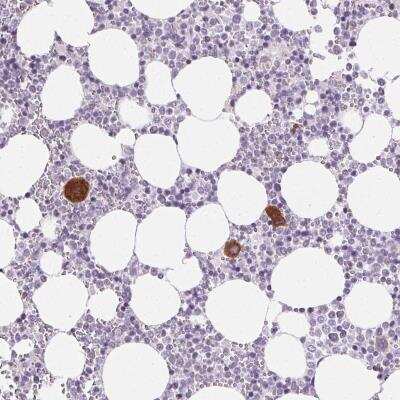 Immunohistochemistry-Paraffin: GPVI Antibody [NBP2-39074]