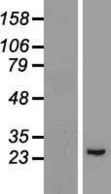 Western Blot: GPX8 Overexpression Lysate [NBL1-11319]