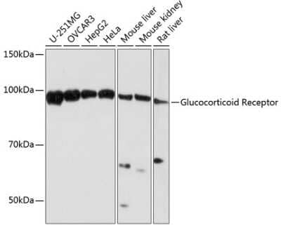 Western Blot: GR/NR3C1 Antibody (2K3E8) [NBP3-15789]