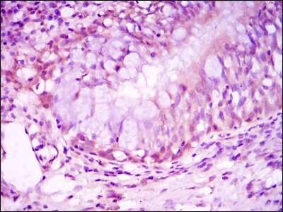 Immunohistochemistry-Paraffin: GR/NR3C1 Antibody (6E6) - BSA Free [NBP2-22174]