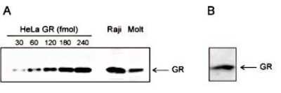 Western Blot: GR/NR3C1 Antibody (C.15200010) [NBP2-59202]