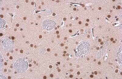 Immunohistochemistry-Paraffin: GR/NR3C1 Antibody (GT1073) [NBP3-13630]