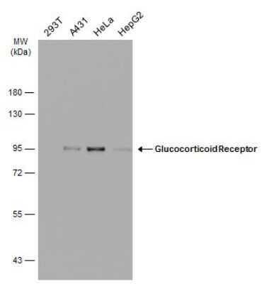 Western Blot: GR/NR3C1 Antibody (GT1073) [NBP3-13630]