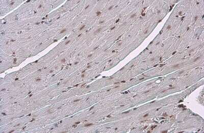 Immunohistochemistry-Paraffin: GR/NR3C1 Antibody (GT248) [NBP3-13626]