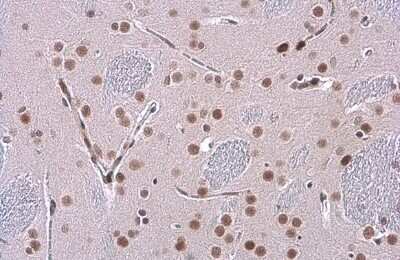 Immunohistochemistry-Paraffin: GR/NR3C1 Antibody (GT248) [NBP3-13626]