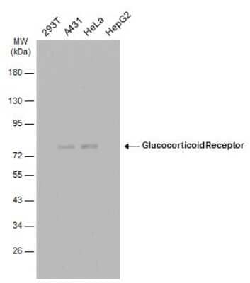 Western Blot: GR/NR3C1 Antibody (GT248) [NBP3-13626]