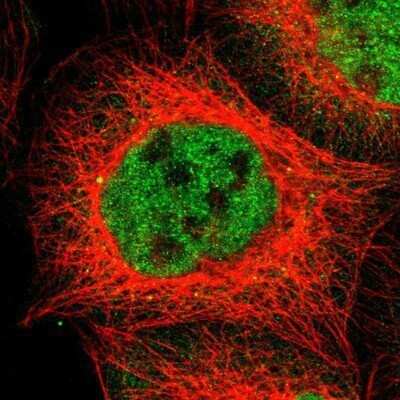 Immunocytochemistry/ Immunofluorescence: GR/NR3C1 Antibody [NBP1-89733]