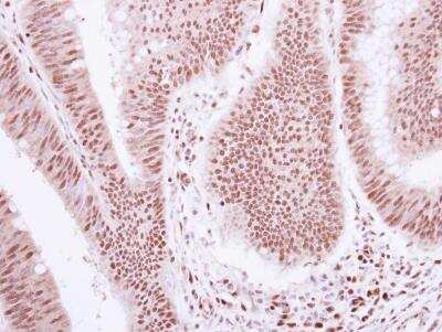 Immunohistochemistry-Paraffin: GR/NR3C1 Antibody [NBP2-42221]