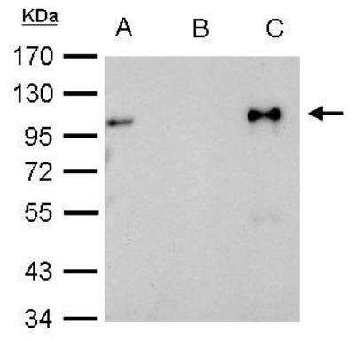 Immunoprecipitation: GR/NR3C1 Antibody [NBP2-42221]