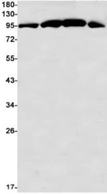 Western Blot: GR/NR3C1 Antibody (S02-5A3) [NBP3-19823]