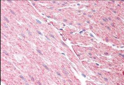 Immunohistochemistry-Paraffin: GRAF Antibody [NB100-1327]