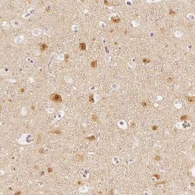 Immunohistochemistry-Paraffin: GRAF Antibody [NBP1-89732]