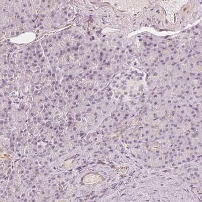 Immunohistochemistry-Paraffin: GRAF Antibody [NBP1-89732]