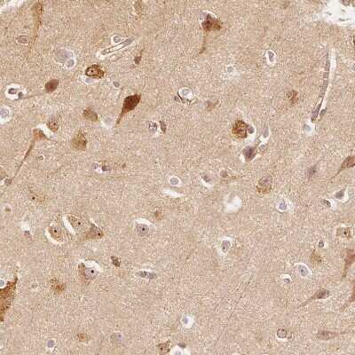 Immunohistochemistry-Paraffin: GRAF Antibody [NBP2-38235]