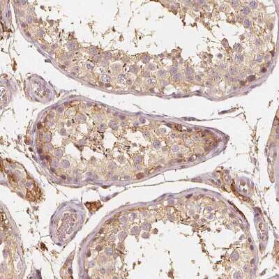 Immunohistochemistry-Paraffin: GRAF Antibody [NBP2-38235]