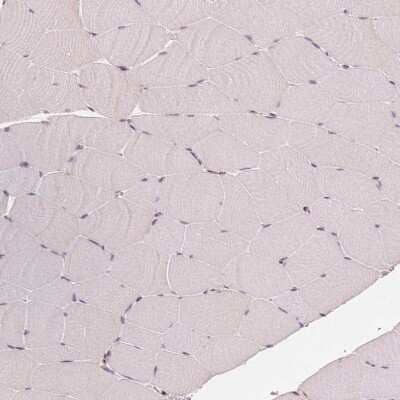 Immunohistochemistry-Paraffin: GRAF Antibody [NBP2-38235]