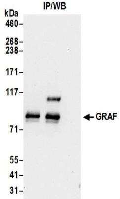 Immunoprecipitation: GRAF Antibody [NBP2-32229]