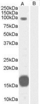 Western Blot: GRAF Antibody [NB100-1327]
