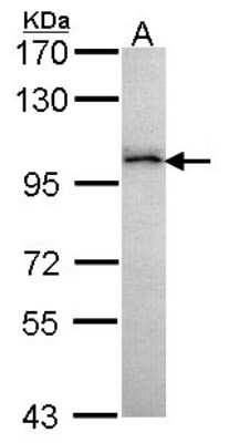 Western Blot: GRAF Antibody [NBP1-33652]