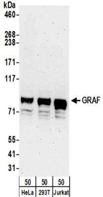 Western Blot: GRAF Antibody [NBP2-32229]