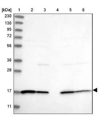 Western Blot: GRAF Antibody [NBP2-38235]