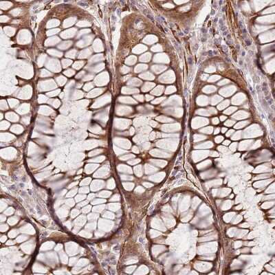 Immunohistochemistry-Paraffin: GRAIL/RNF128 Antibody [NBP2-13237]