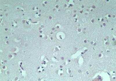 Immunohistochemistry-Paraffin: GRAIL/RNF128 Antibody [NBP2-24610]