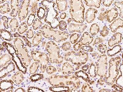 Immunohistochemistry-Paraffin: GRAIL/RNF128 Antibody [NBP2-97643]