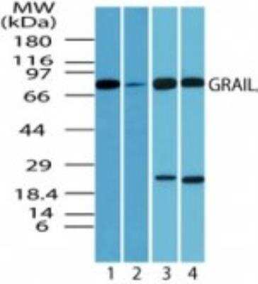 Western Blot: GRAIL/RNF128 Antibody [NBP2-24610]
