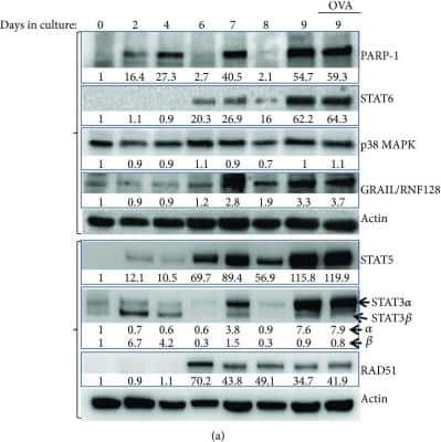 Western Blot: GRAIL/RNF128 Antibody [NBP2-24610]