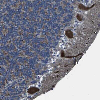 Immunohistochemistry-Paraffin: GRAMD1A Antibody [NBP1-93729]