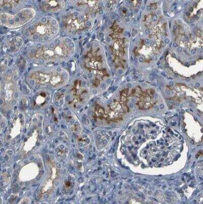 Immunohistochemistry-Paraffin: GRAMD1A Antibody [NBP1-93729]