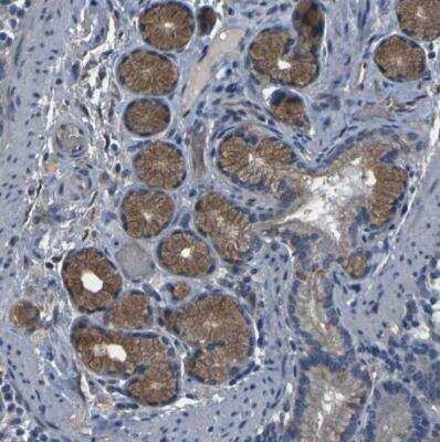 Immunohistochemistry-Paraffin: GRAMD1A Antibody [NBP1-93729]