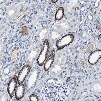 Immunohistochemistry-Paraffin: GRAMD1A Antibody [NBP1-93730]