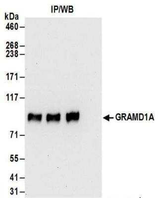 Immunoprecipitation: GRAMD1A Antibody [NBP2-32147]