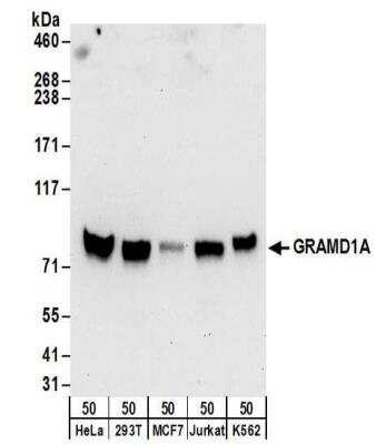 Western Blot: GRAMD1A Antibody [NBP2-32148]