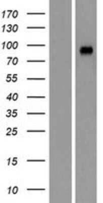 Western Blot: GRAMD1A Overexpression Lysate [NBP2-09607]