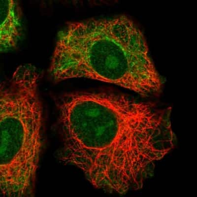 Immunocytochemistry/ Immunofluorescence: GRAMD1B Antibody [NBP1-81431]