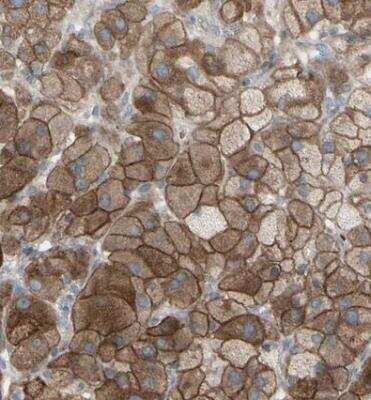 Immunohistochemistry-Paraffin: GRAMD1B Antibody [NBP1-81431]