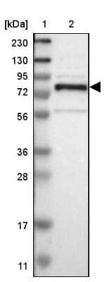 Western Blot: GRAMD1C Antibody [NBP1-90559]