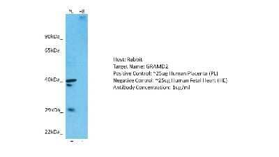 Western Blot: GRAMD2 Antibody [NBP1-80540]