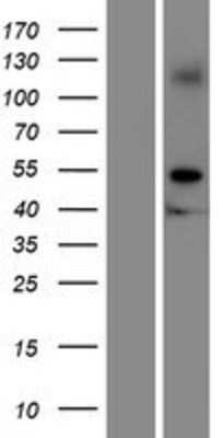 Western Blot: GRAMD2 Overexpression Lysate [NBP2-08700]