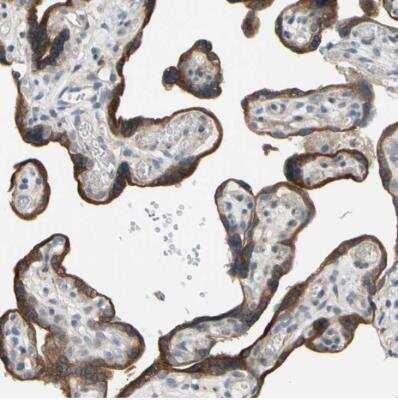 Immunohistochemistry-Paraffin: GRAMD3 Antibody [NBP1-82150]
