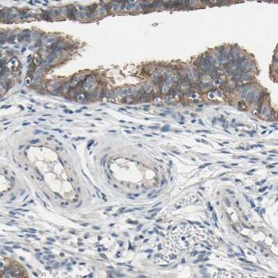 Immunohistochemistry-Paraffin: GRAMD3 Antibody [NBP1-82150]