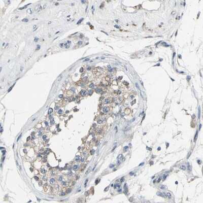 Immunohistochemistry-Paraffin: GRAMD3 Antibody [NBP1-82150]