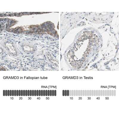 Immunohistochemistry-Paraffin: GRAMD3 Antibody [NBP1-82150]
