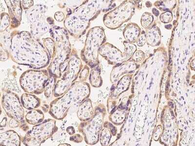 Immunohistochemistry-Paraffin: GRAMD3 Antibody [NBP2-97825]