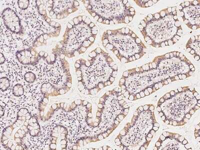 Immunohistochemistry-Paraffin: GRAMD3 Antibody [NBP2-97825]