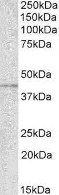 Western Blot: GRAMD3 Antibody [NBP1-52086]