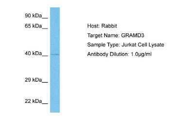 Western Blot: GRAMD3 Antibody [NBP2-87528]